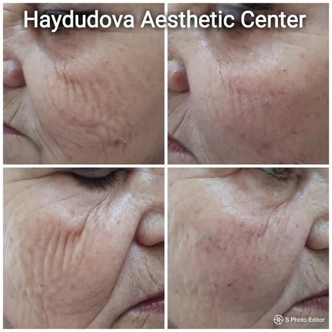 Haydudova Aesthetic Center - city of Pleven | Medical Offices and Clinics - снимка 4