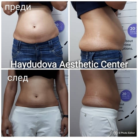 Haydudova Aesthetic Center - city of Pleven | Medical Offices and Clinics - снимка 5
