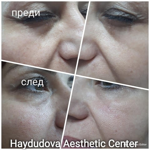 Haydudova Aesthetic Center - city of Pleven | Medical Offices and Clinics - снимка 6